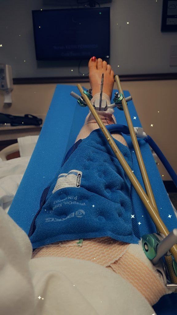 A lower leg is supported on a medical device with external stabilizing pins and cushioning during a clinical procedure.